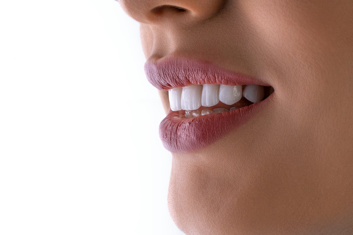 A bright white smile