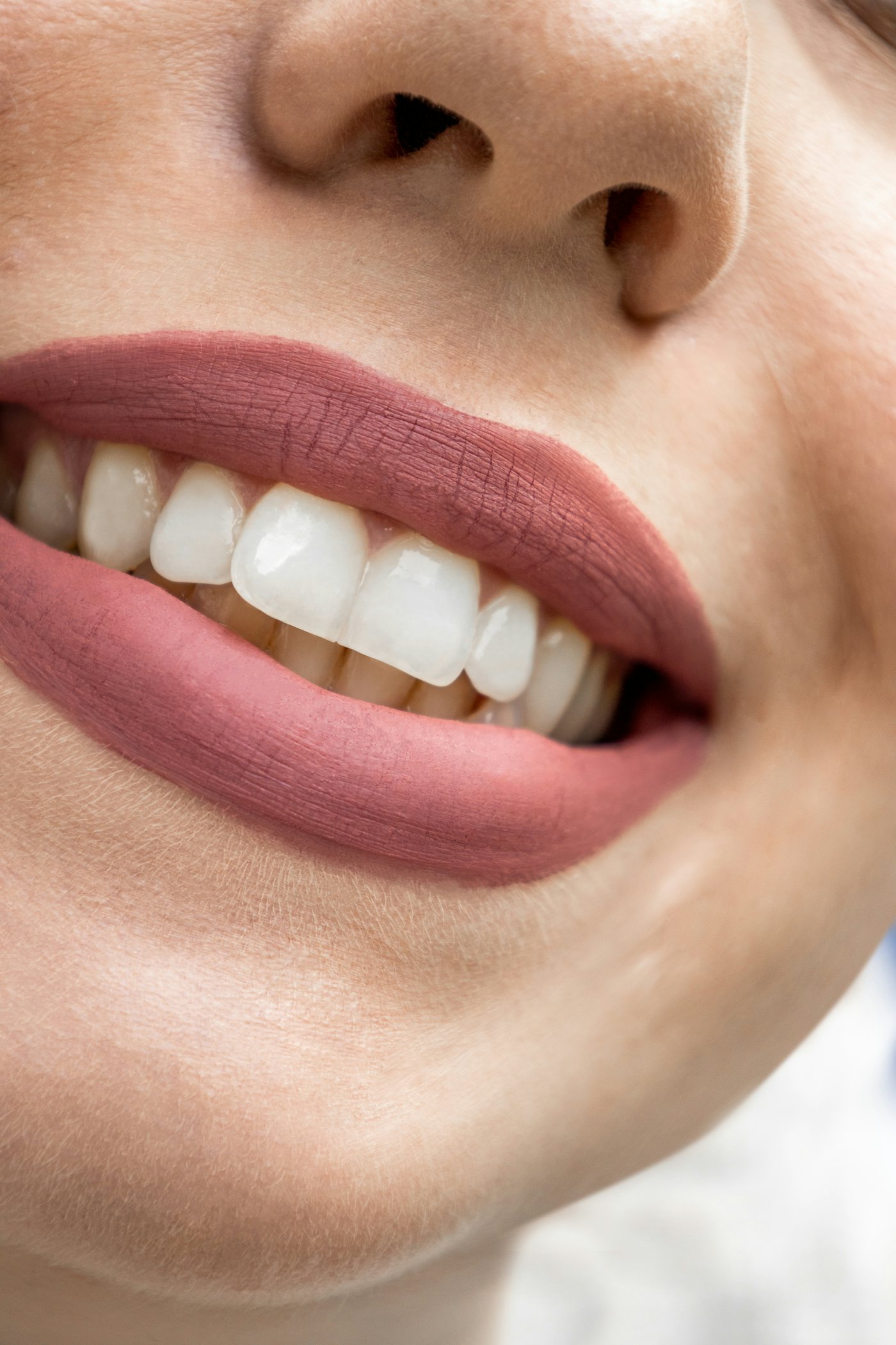 A close-up of a bright smile